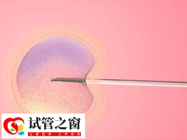 試管移植之后體內(nèi)激素水平會出現(xiàn)變化