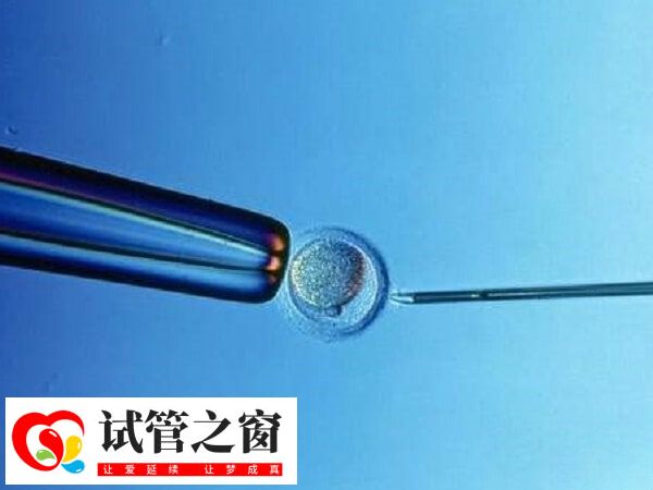 試管嬰兒成功率在50%左右