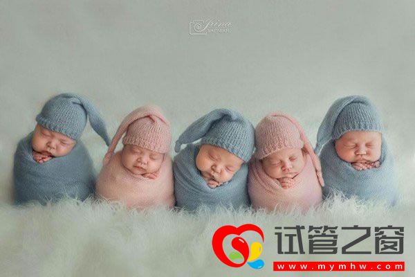 試管之窗